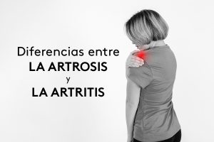 diferencias-entre-la-artrosis-y-la-artritis